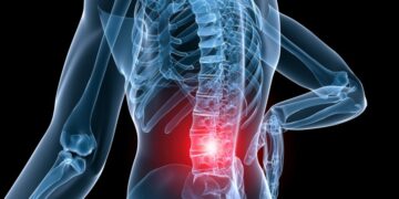 best therapeutic techniques for back pain by Meghan Krupka LMT @ Bodyworks DW Advanced Massage Therapy